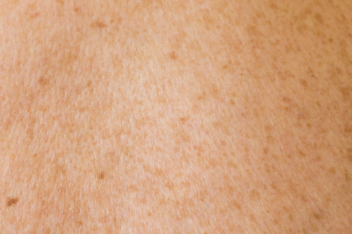 Seasonal skin care adjustments